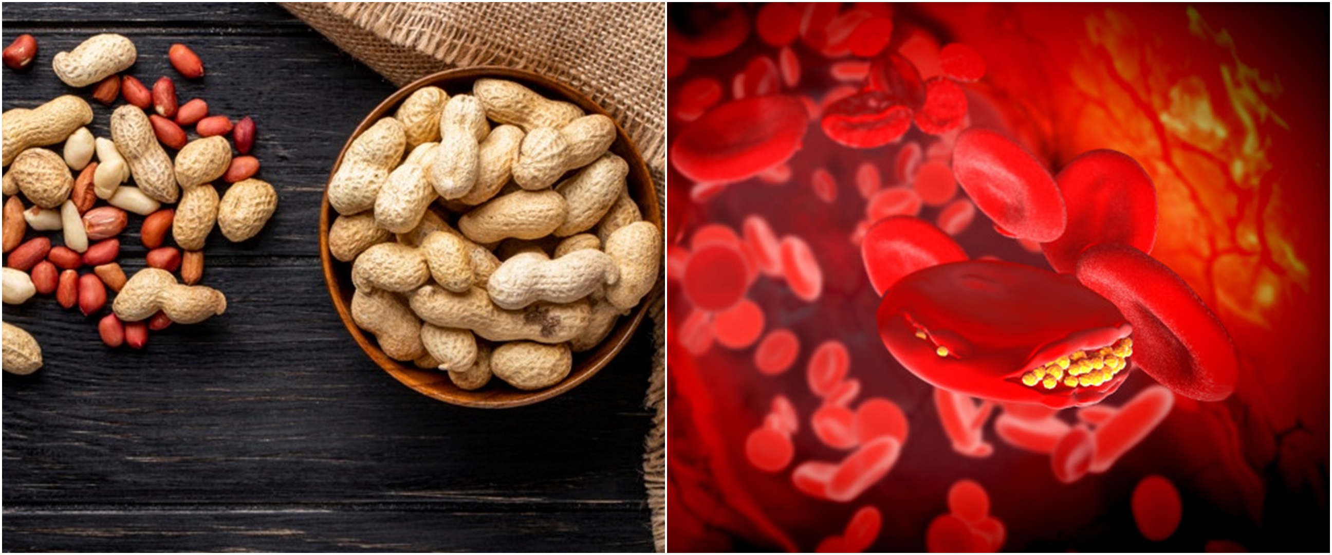 8 Manfaat kacang tanah untuk kesehatan, menurunkan kolesterol