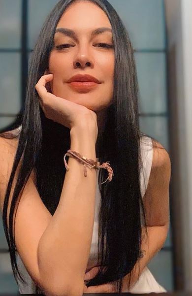 Viral hasil rontgen Sophia Latjuba, dinilai cantik sampai ke tengkorak