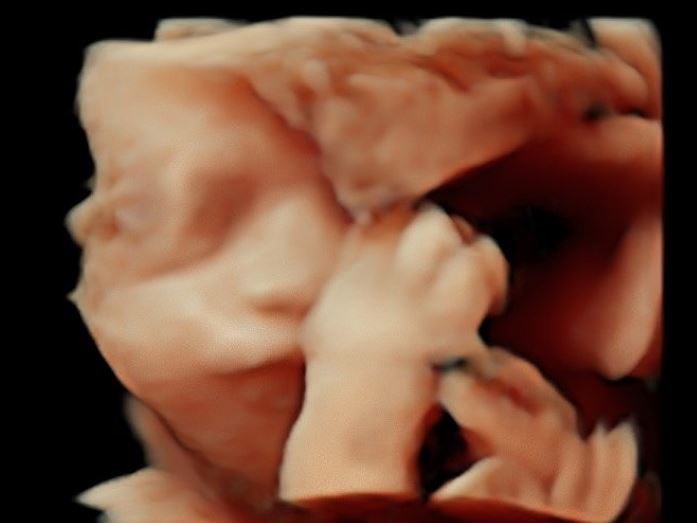 Dipuji berhidung mancung, ini potret hasil USG 3D anak Vebby Palwinta