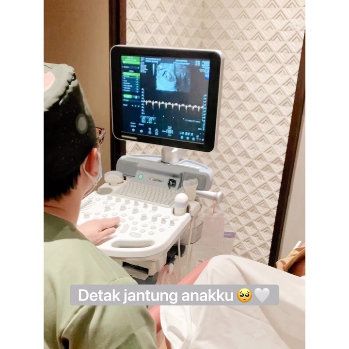 10 Momen Audi Marissa cek kandungan, beri panggilan gemas untuk anak