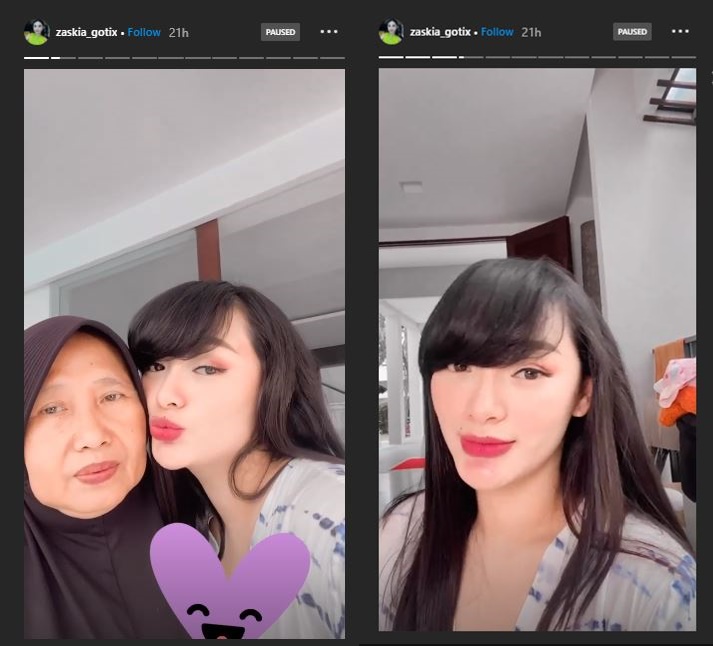 Potret terbaru Zaskia Gotik usai melahirkan, kian menawan