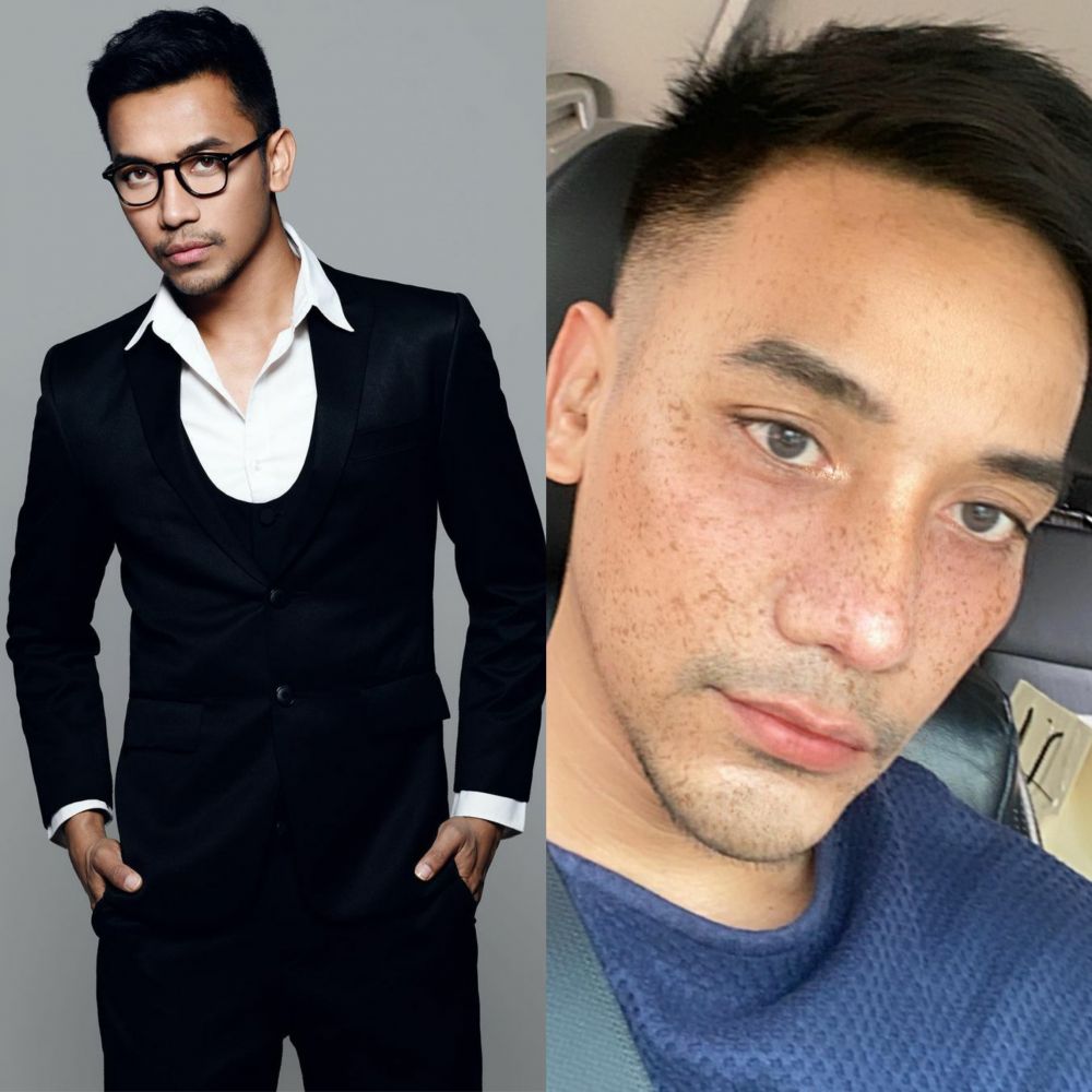 Potret 7 seleb sebelum dan sesudah operasi plastik, bikin pangling