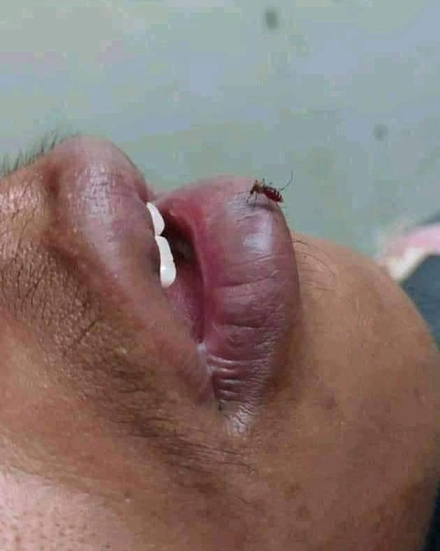  10 Momen lucu nyamuk asal nemplok ini bikin senyum sekaligus heran