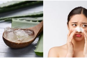 Cara membuat masker lidah buaya untuk obat komedo, mudah dan ampuh