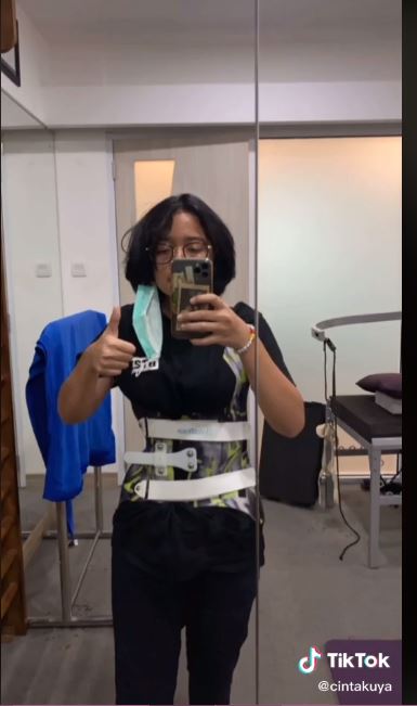 10 Potret dan cerita perjuangan Cinta Kuya melawan skoliosis