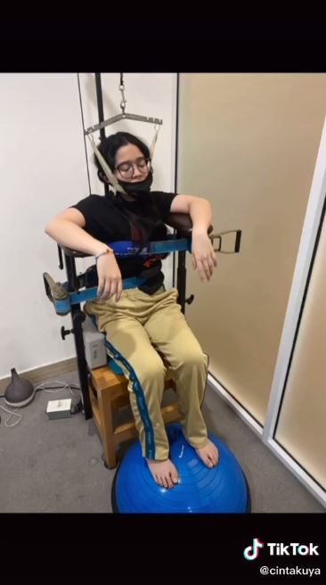 10 Potret dan cerita perjuangan Cinta Kuya melawan skoliosis