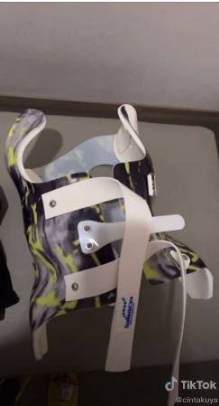 10 Potret dan cerita perjuangan Cinta Kuya melawan skoliosis