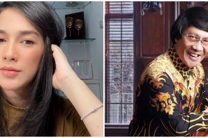 Jarang terekspos, potret rambut asli 5 seleb ini jadi sorotan