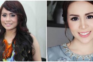 Potret dulu dan kini 5 seleb yang hilangkan gingsul