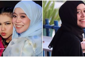 9 Potret Lesty Kejora sebelum & sesudah pakai behel, hilangkan gingsul