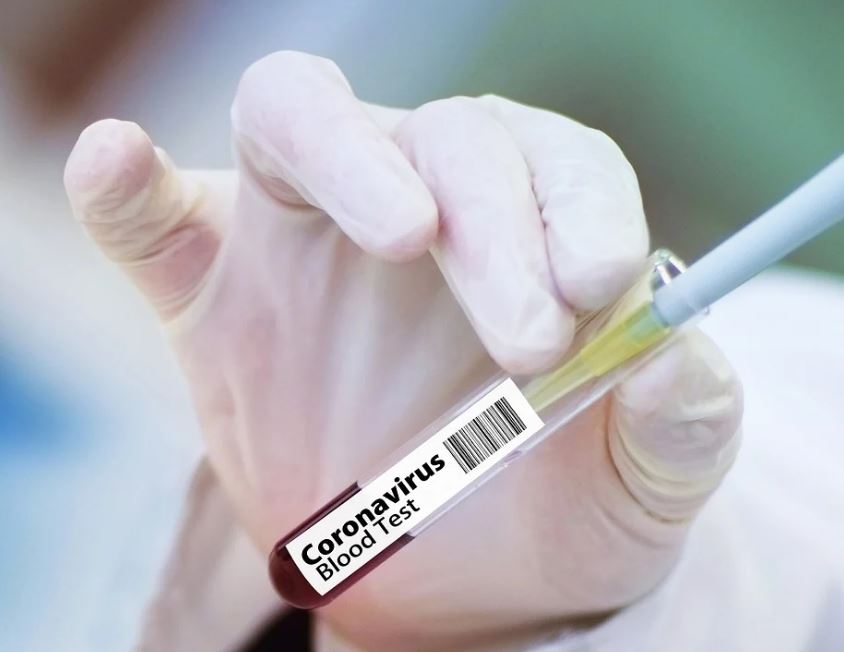 Ramai diperbincangkan, ini 5 fakta vaksin Covid-19 gratis di Indonesia
