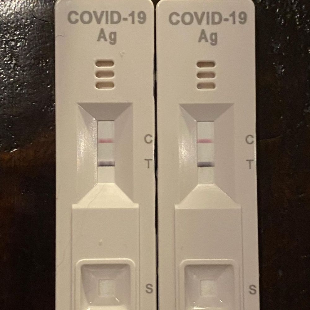 Nirina Zubir dan suami positif Covid-19, rasakan hilang penciuman