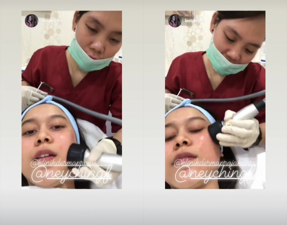 5 Momen Lesty Kejora perawatan kecantikan, botox hingga tanam benang