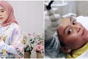 5 Momen Lesty Kejora perawatan kecantikan, botox hingga tanam benang