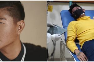 4 Fakta Andika eks Kangen Band positif Covid-19, alami sesak napas