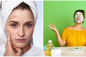 5 Cara membuat masker lidah buaya campur madu, aman dan mudah