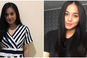 10 Potret terbaru Juwita Bahar, sempat alami koma & sudah menikah