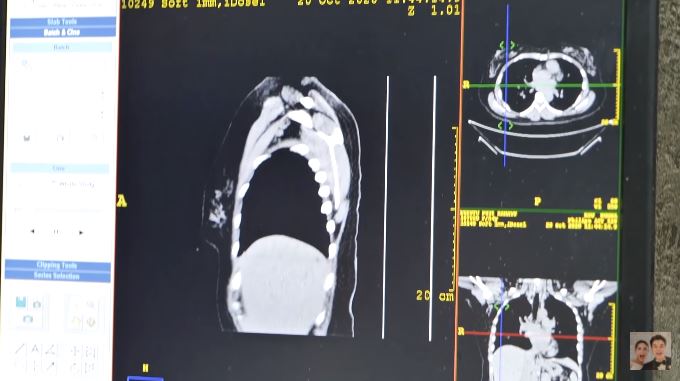 10 Momen Paula Verhoeven jalani MRI karena bobot naik 25 kg saat hamil