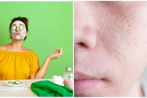 5 Cara membuat masker lidah buaya untuk mengecilkan pori-pori