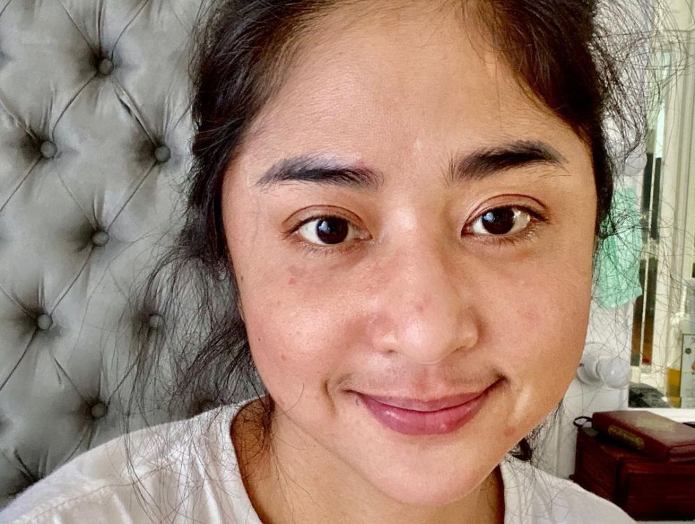 Perjuangan 17 seleb sembuh dari Covid-19, inspiratif dan bikin haru