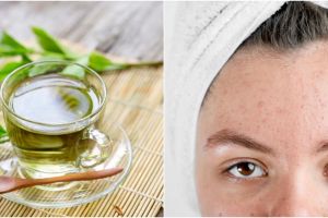 10 Manfaat teh hijau untuk kecantikan, dapat mengobati jerawat