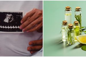 6 Cara mengatasi jerawat saat hamil, alami dan mudah dicoba