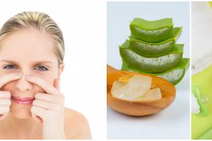 Cara membuat masker lidah buaya & baby oil, bisa hilangkan komedo