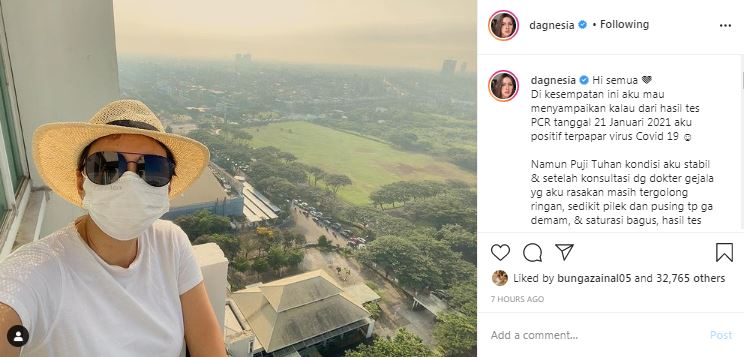 Donna Agnesia umumkan dirinya positif Covid-19, alami gejala ringan