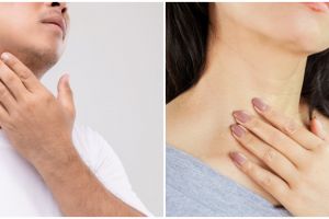 6 Tanaman obat amandel, dapat mengobati tanpa operasi