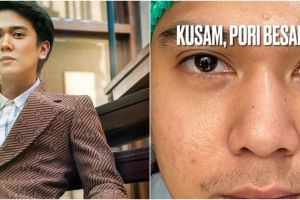 7 Potret Iqbaal Ramadhan lakukan perawatan kulit, ditangani Tompi