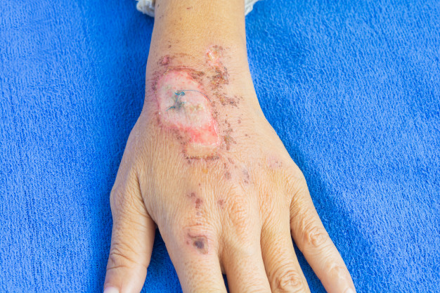 Cara membuat teh bidara, minuman herbal yang kaya manfaat