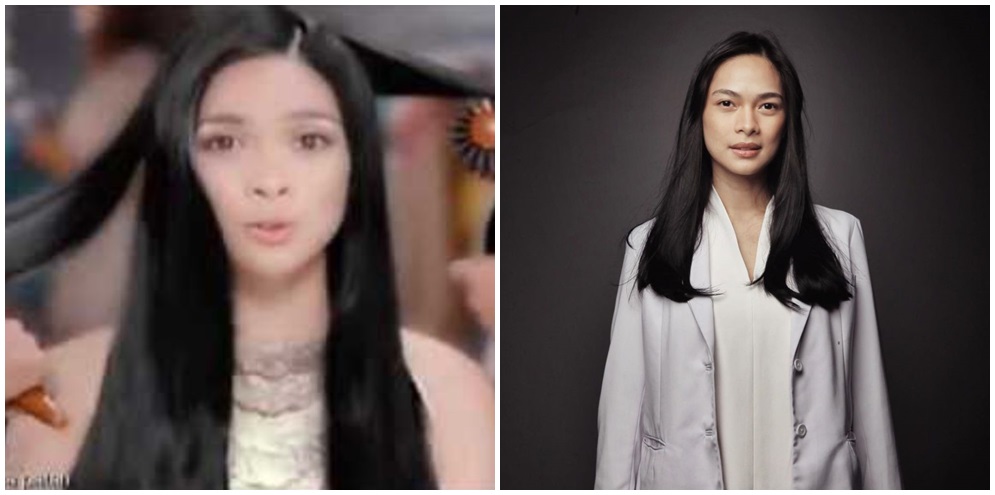 Potret dulu dan kini 8 seleb yang pilih jadi dokter, bikin pangling