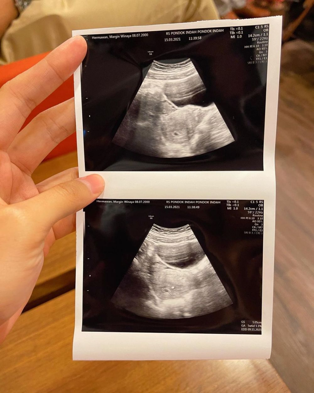 8 Momen Margin Wieheerm dan Ali Syakieb umumkan kehamilan