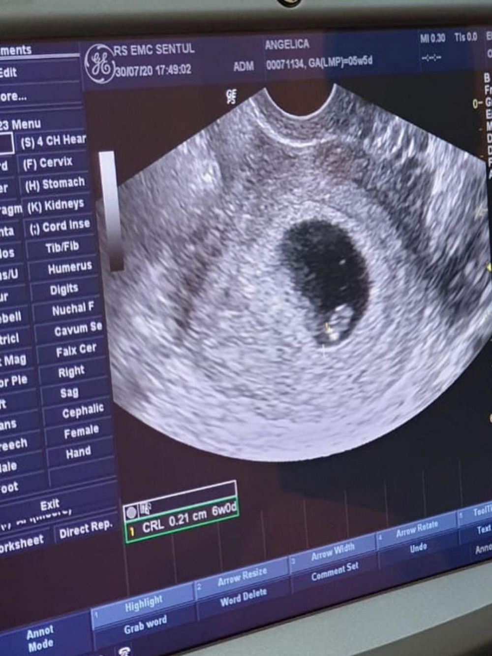 7 Potret perjalanan kehamilan Angelica Simperler hingga melahirkan