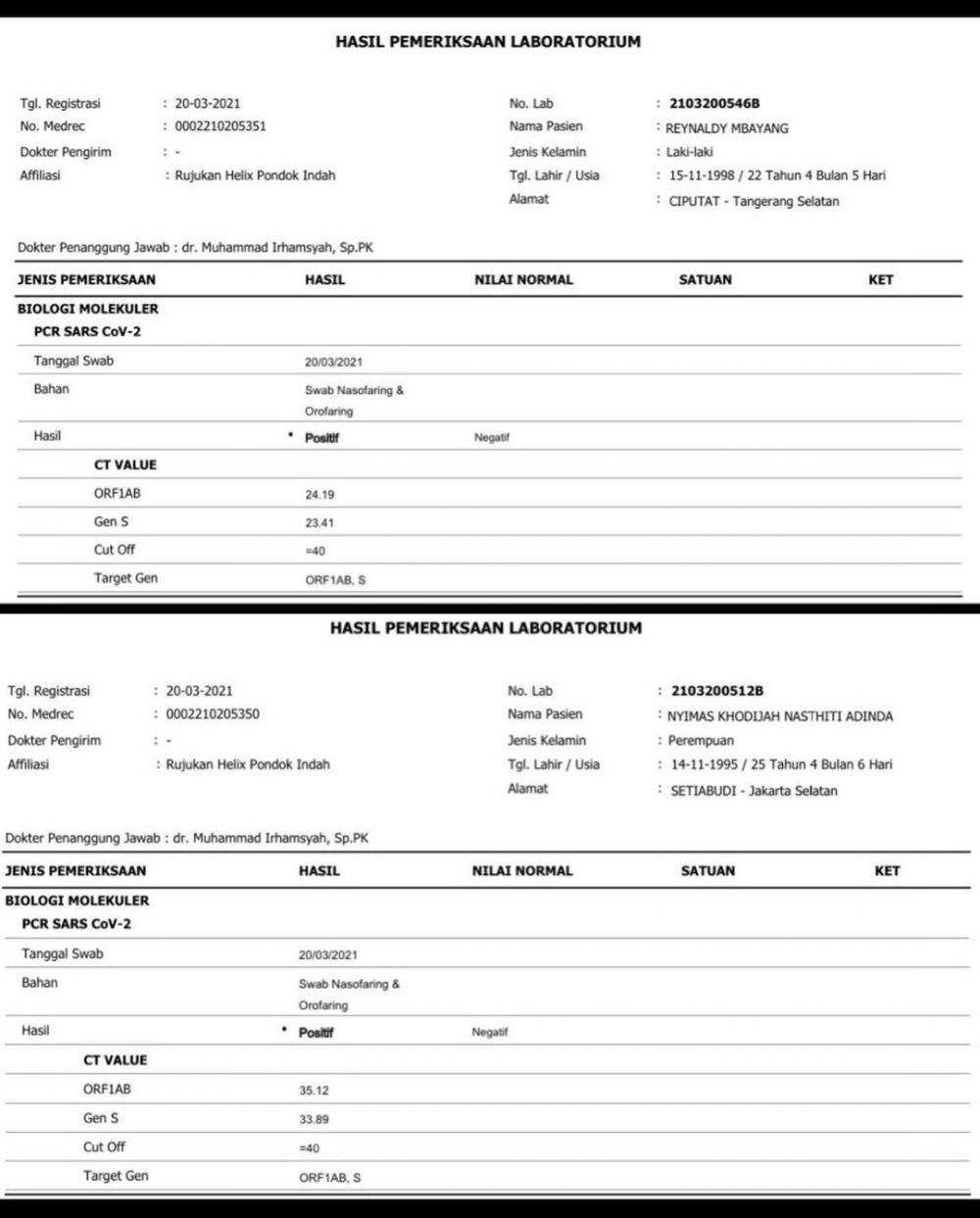 Rey Mbayang dan Dinda Hauw umumkan positif Covid-19