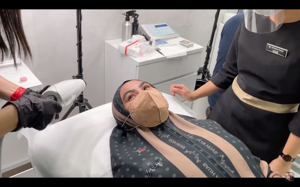 8 Cerita dan momen Kartika Putri laser alis, hasilnya mengejutkan