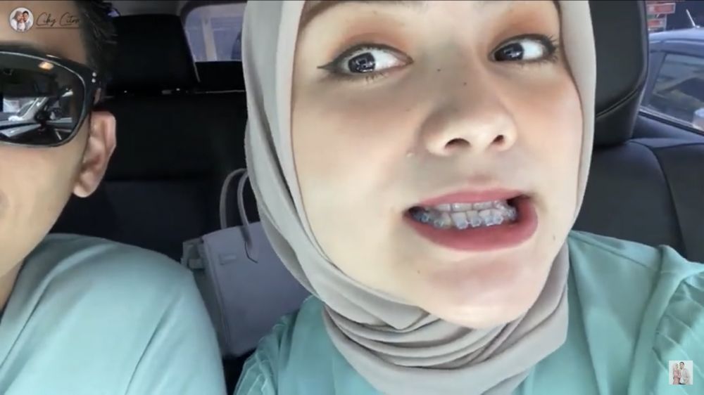 8 Momen Citra Kirana pasang behel, tampilannya jadi manglingi