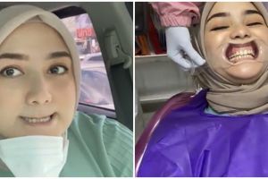 8 Momen Citra Kirana pasang behel, tampilannya jadi manglingi