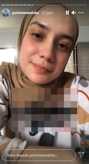 10 Pesona Putri Anne tanpa makeup, bukti cantiknya alami