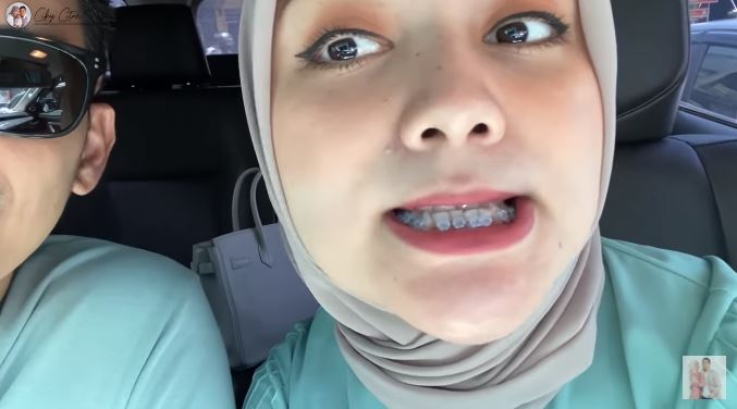 7 Momen Citra Kirana pasang behel, kembaran dengan Rezky Aditya