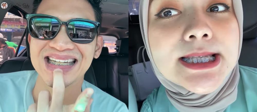 7 Momen Citra Kirana pasang behel, kembaran dengan Rezky Aditya