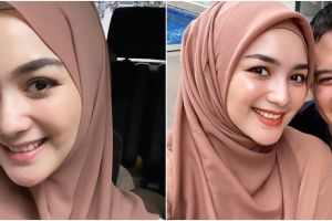 7 Momen Citra Kirana pasang behel, kembaran dengan Rezky Aditya