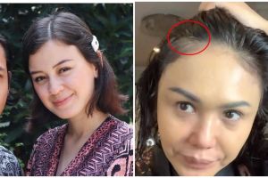 Potret 8 seleb tak sungkan tunjukkan rambut beruban, tetap menawan