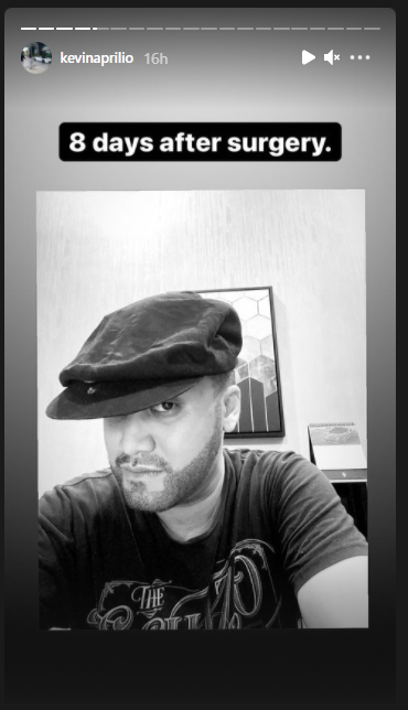 Usai transplantasi rambut, penampilan Kevin Aprilio bikin pangling