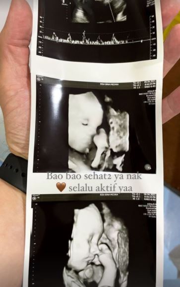 5 Momen Audi Marissa melahirkan anak pertama, lahir secara prematur