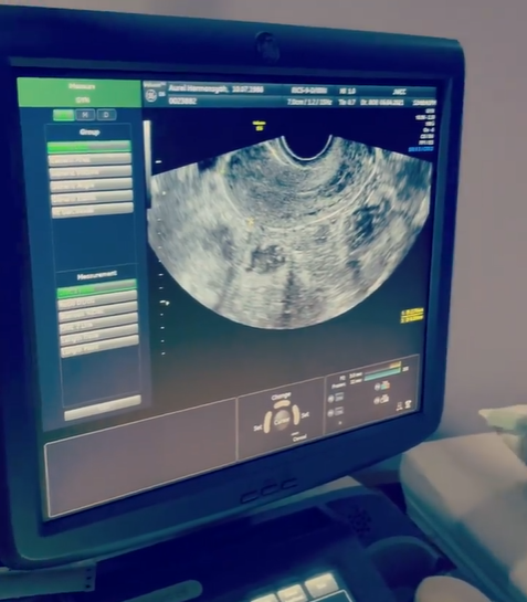 10 Momen Atta Halilintar temani Aurel Hermansyah cek kandungan