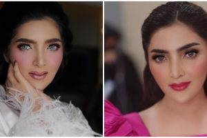 Pose bareng sahabatnya, wajah Ashanty bikin warganet khawatir