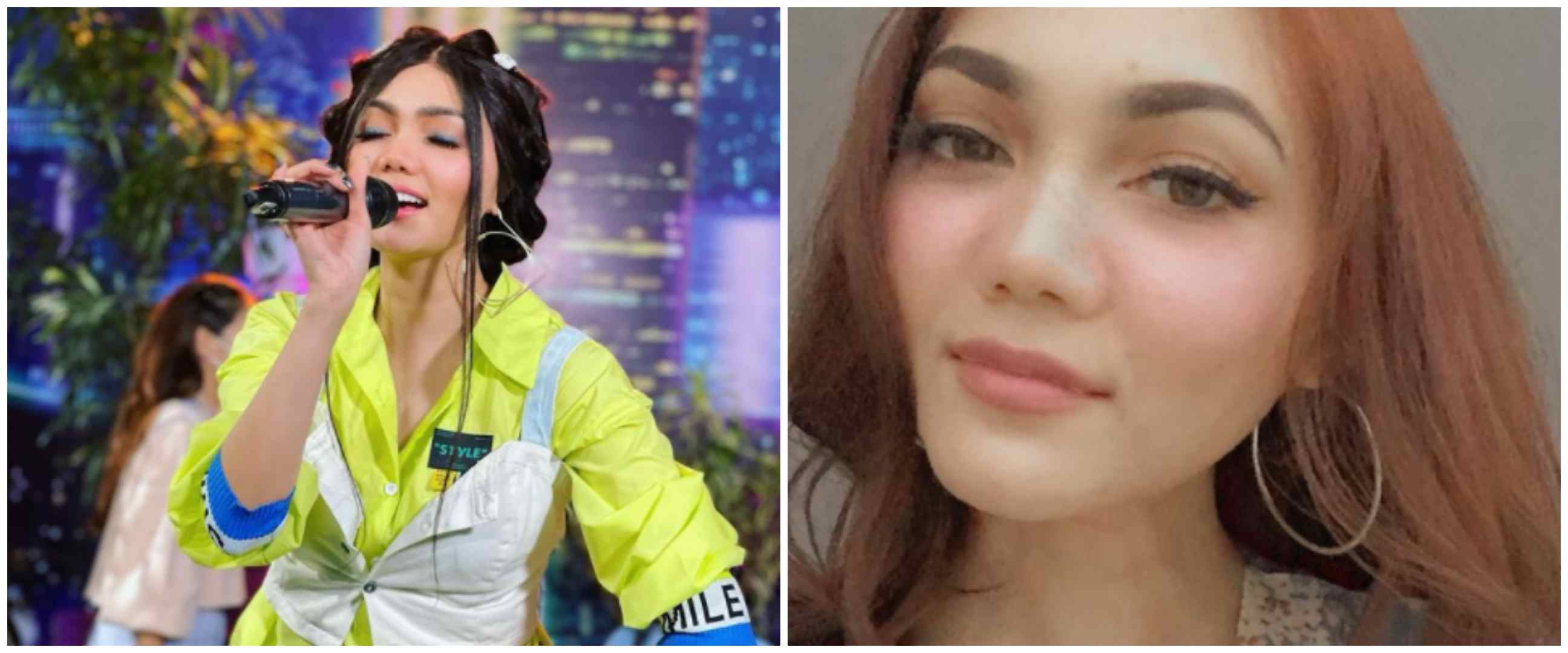 15 Penampilan Rina Nose tiru gaya seleb lain, kocak tapi mirip banget