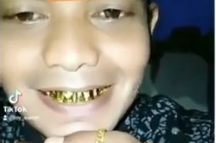 Viral cowok pamer perhiasan hingga gigi emas, gusi sampai bengkak