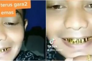 Viral cowok pamer perhiasan hingga gigi emas, gusi sampai bengkak